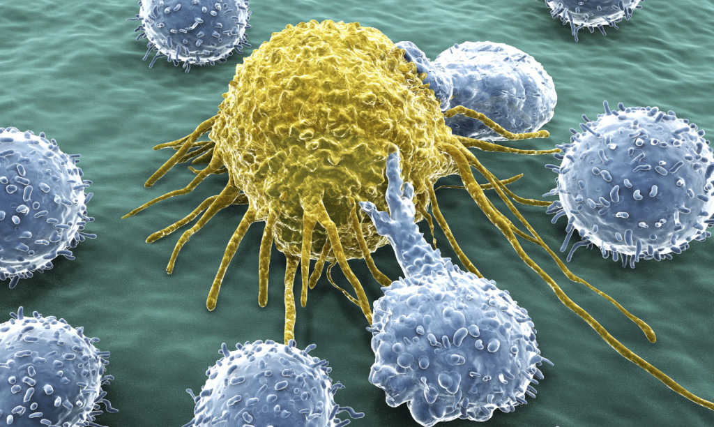 CancerCells