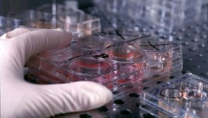 Cellule staminali, nuova arma contro l'ictus secondo una ricerca italiana